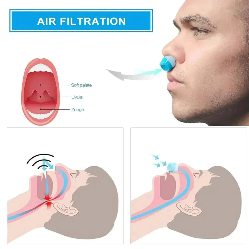 Micro CPAP Machine | Hoseless Silent & USB-Rechargeable | 8-Hour Battery Life