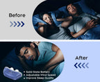 Anti-Snoring Device | Mask-Free & USB-Rechargeable | Travel Size