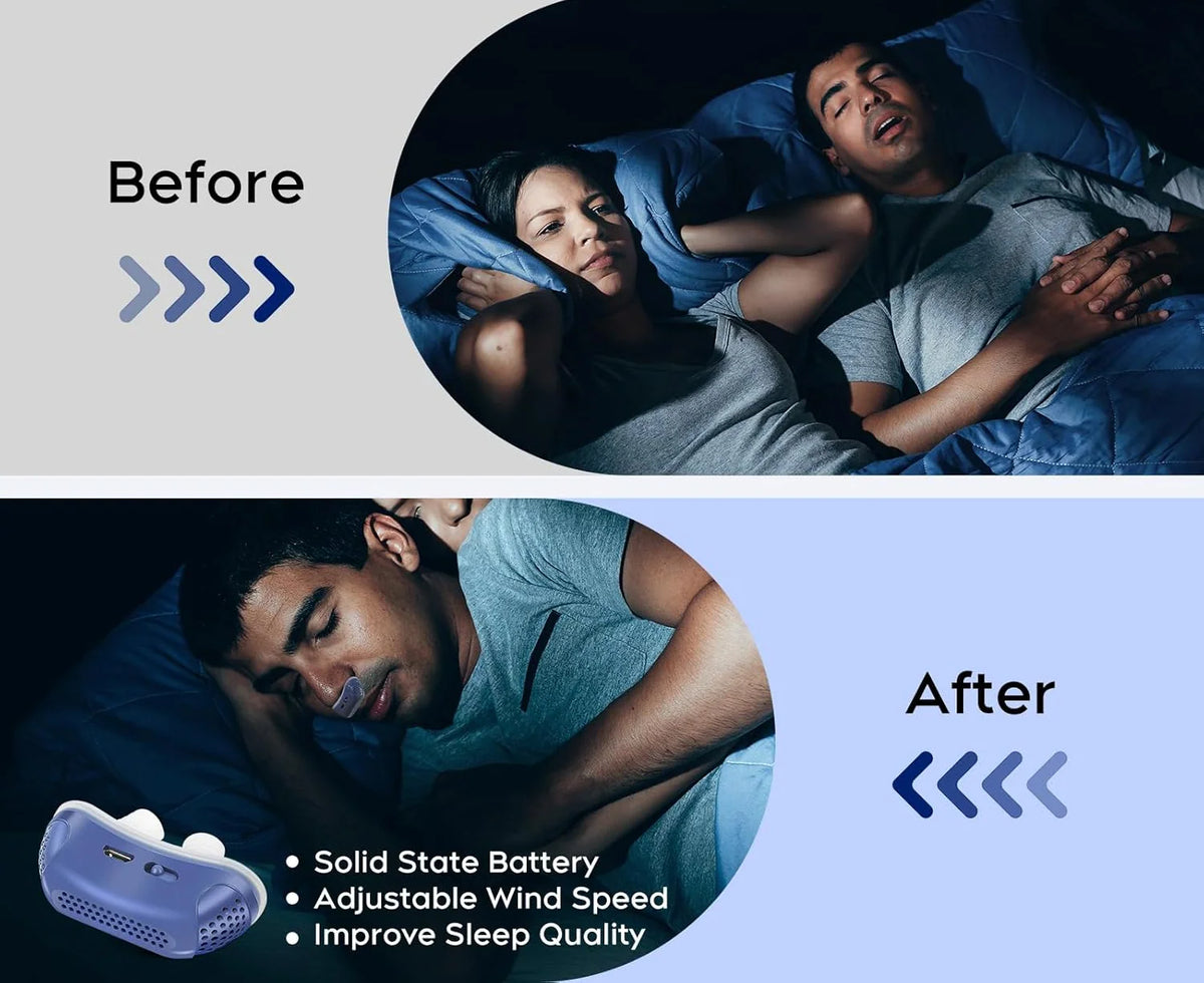 Anti-Snoring Device | Mask-Free & USB-Rechargeable | Travel Size