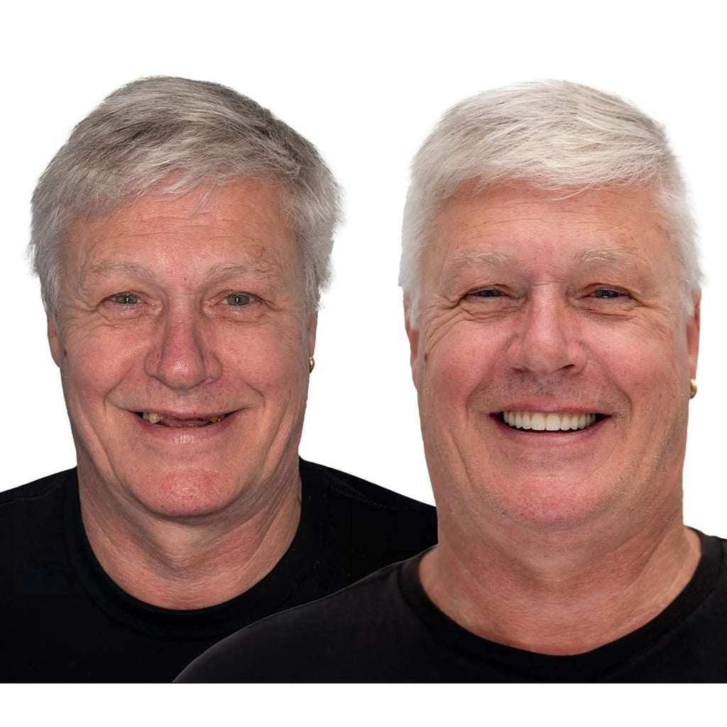 Denture Set | Natural-Looking Flexible Cushion Grip | Upper & Lower Full Arch