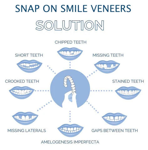 Clip-On Veneers | Instant Natural-Looking & Comfortable | Upper & Lower