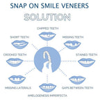 Clip-On Veneers | Instant Natural-Looking & Comfortable | Upper & Lower