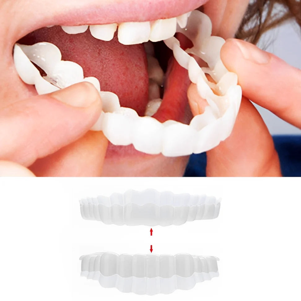 Clip-On Veneers | Instant Natural-Looking & Comfortable | Upper & Lower